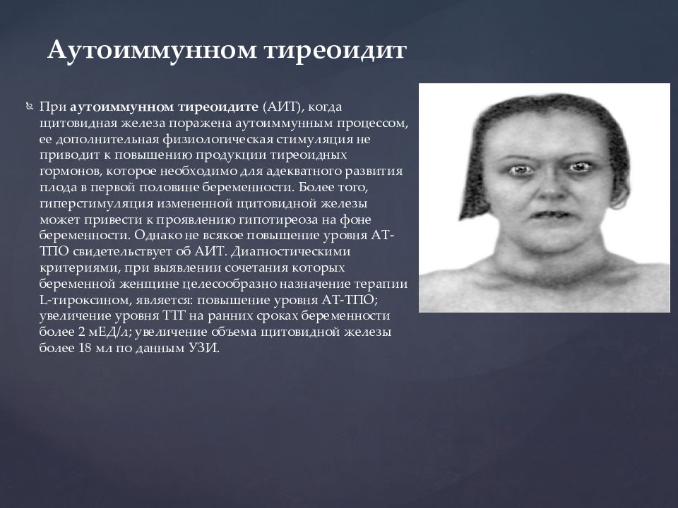 Диета При Аутоиммунном Заболевании Щитовидной Железы