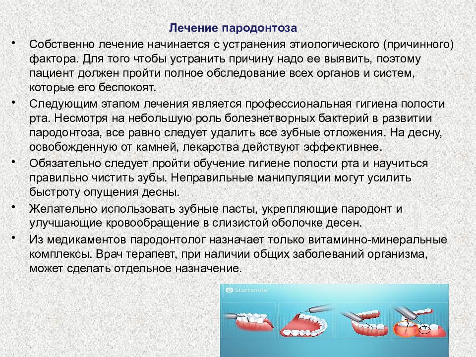 Лечение пародонтоза Томск Карский улыбка стоматология на лазо томск