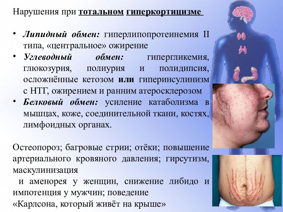 Патологии некоторых эндокринных желез ( гипофиза, щитовидной железы и