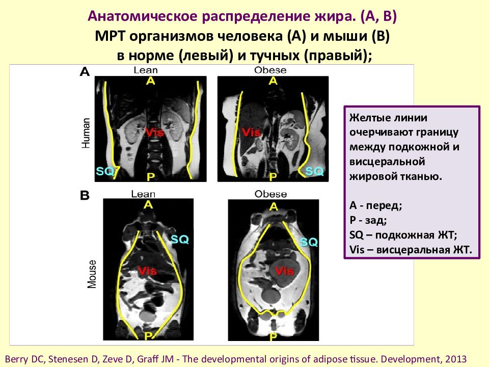 Анатомическое распределение жира. (A, B) МРТ организмов человека (A) и мыши (B) в норме (левый) и тучных (правый);