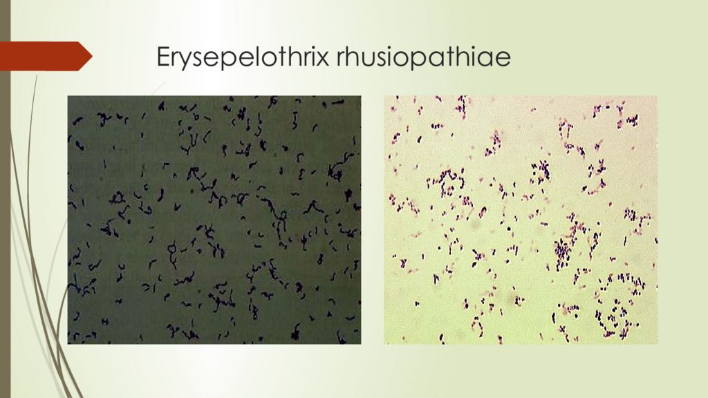 Erysepelothrix rhusiopathiae