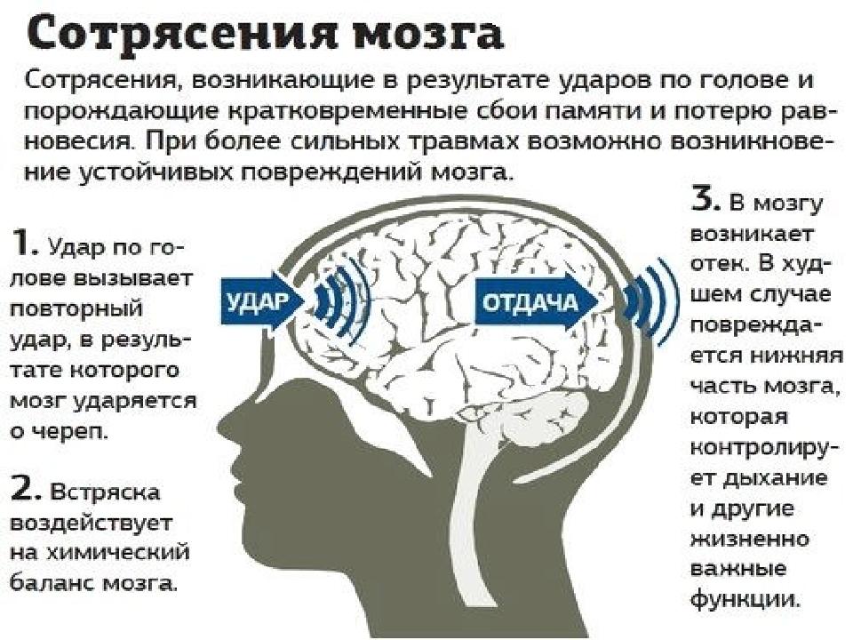 Сотрясение головного мозга