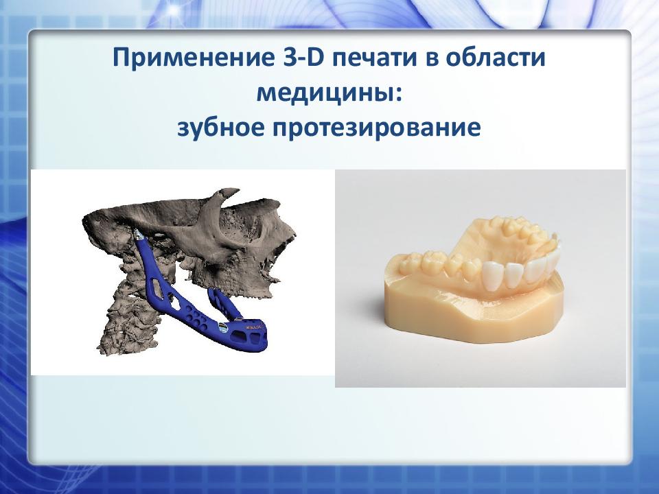 Применение 3- D печати в области медицины: зубное протезирование