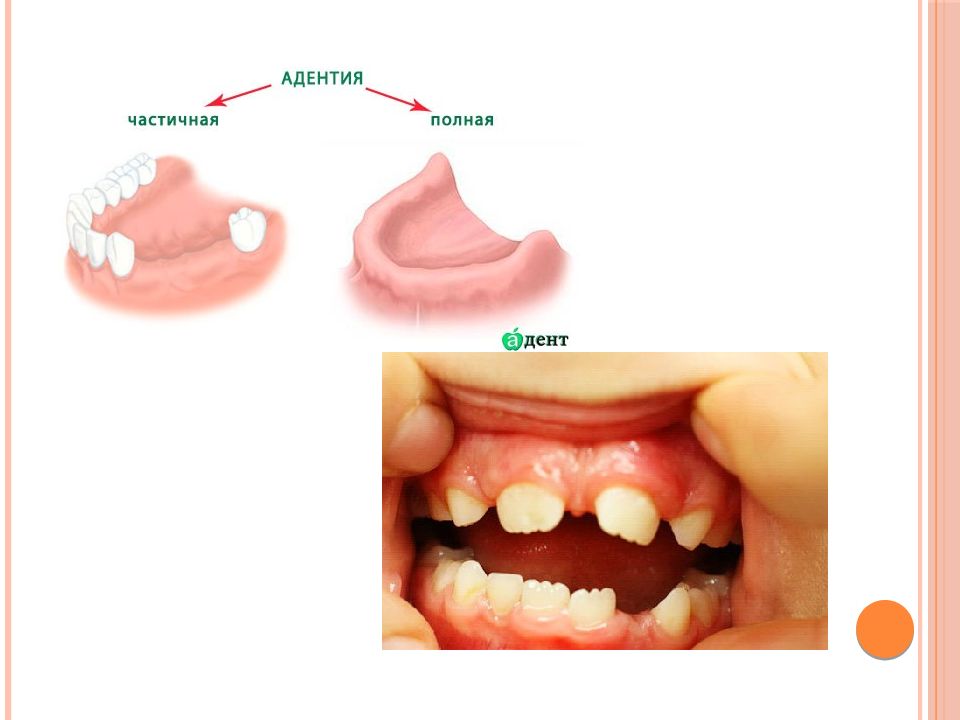 Профилактика зубочелюстных аномалий у детей