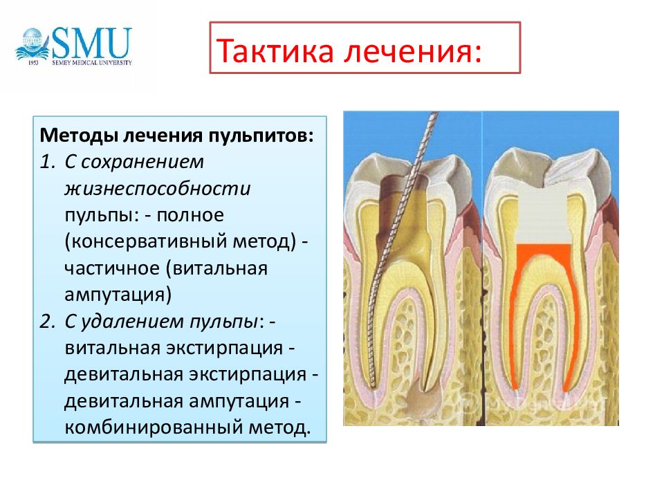 Лечение пульпита Томск Милый детская стоматология в томске