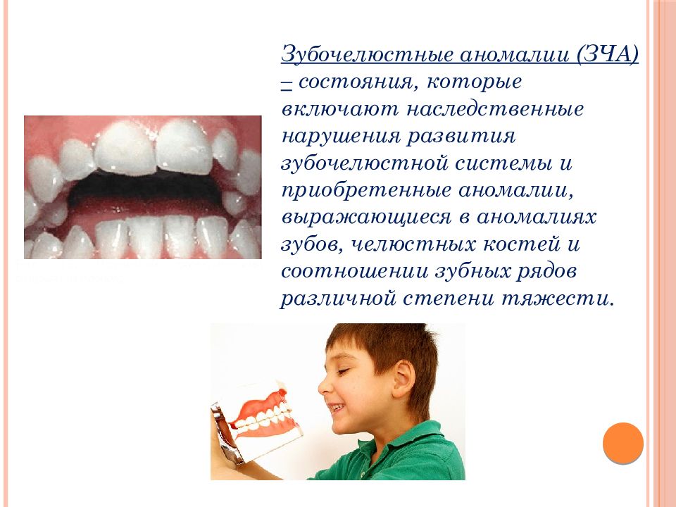 Профилактика зубочелюстных аномалий у детей