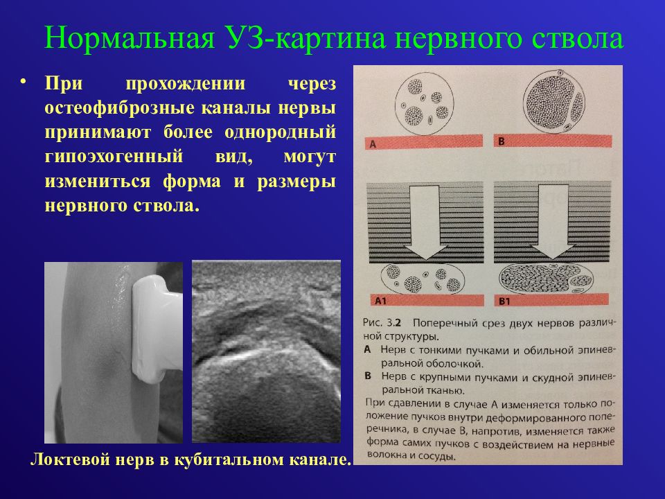  Отчет по практике по теме Радиолокационный уровнемер УРМД 01